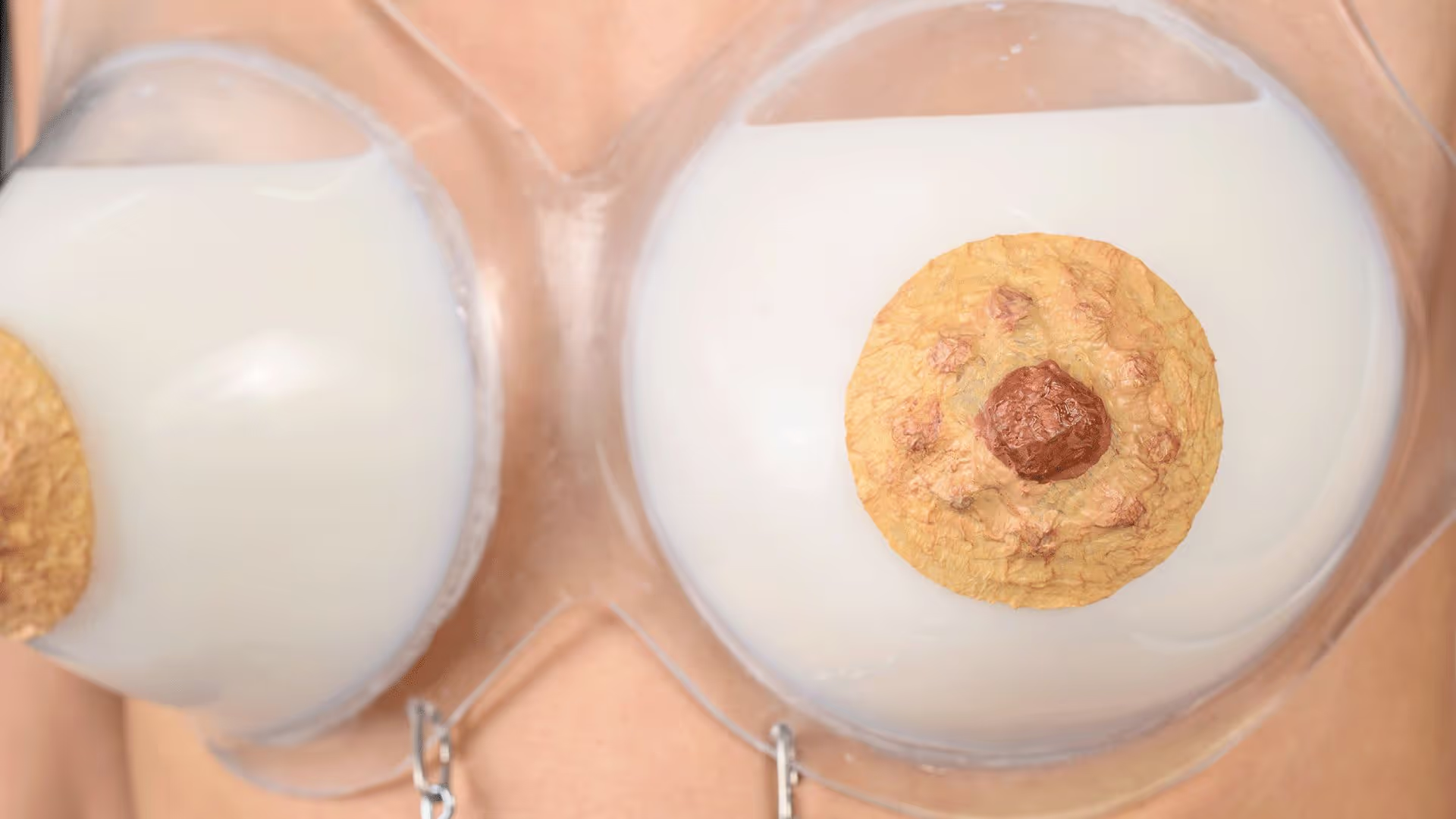 In Case of Emergency, Deborah Bassett, New Zealand